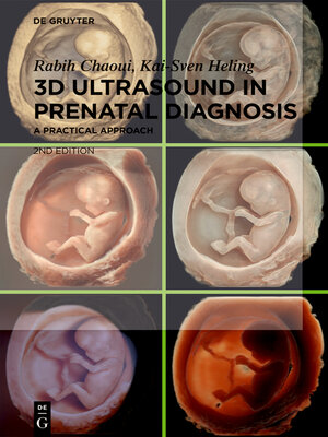 cover image of 3D Ultrasound in Prenatal Diagnosis